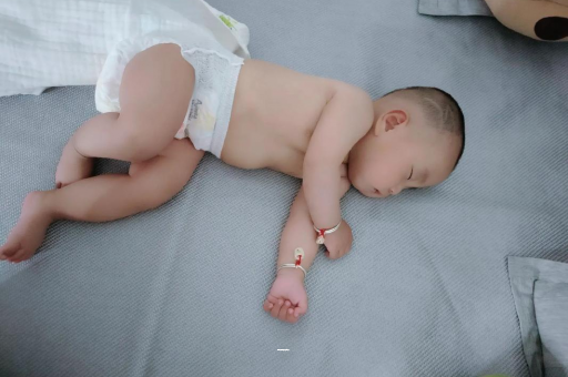 泰兴宝宝黄疸值多少才正常